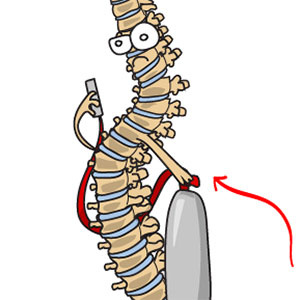 Attack of the Spine
