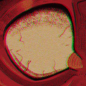 The Crimson Horror