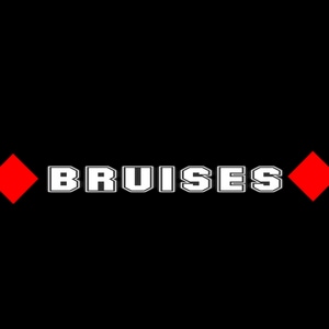  Chapter 4-Bruises