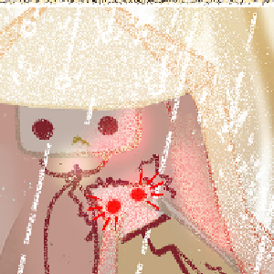 Coping
