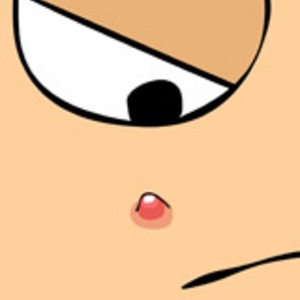 Pimples...
