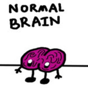 A normal brain vs. an autistic brain