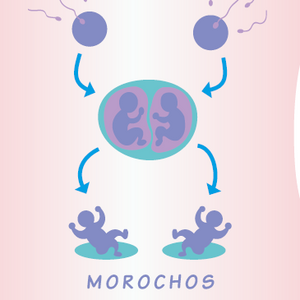 Morochos / Twins 