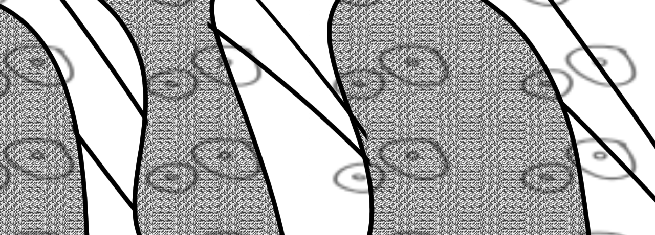 custom banner