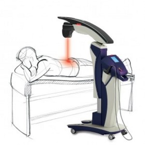 Laser Therapy for Back Pain