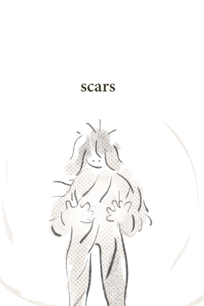 scars