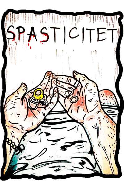 Spasticitet